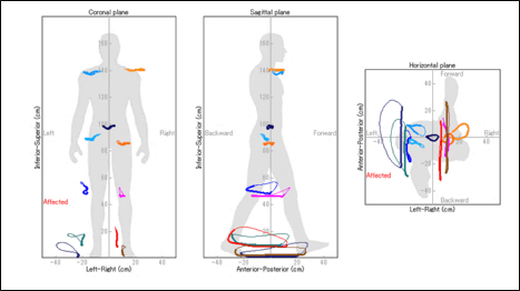 ���T�W���[�O�ϐ}