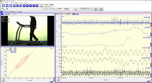 BIMUTAS-Video for ECG�̃��C�����